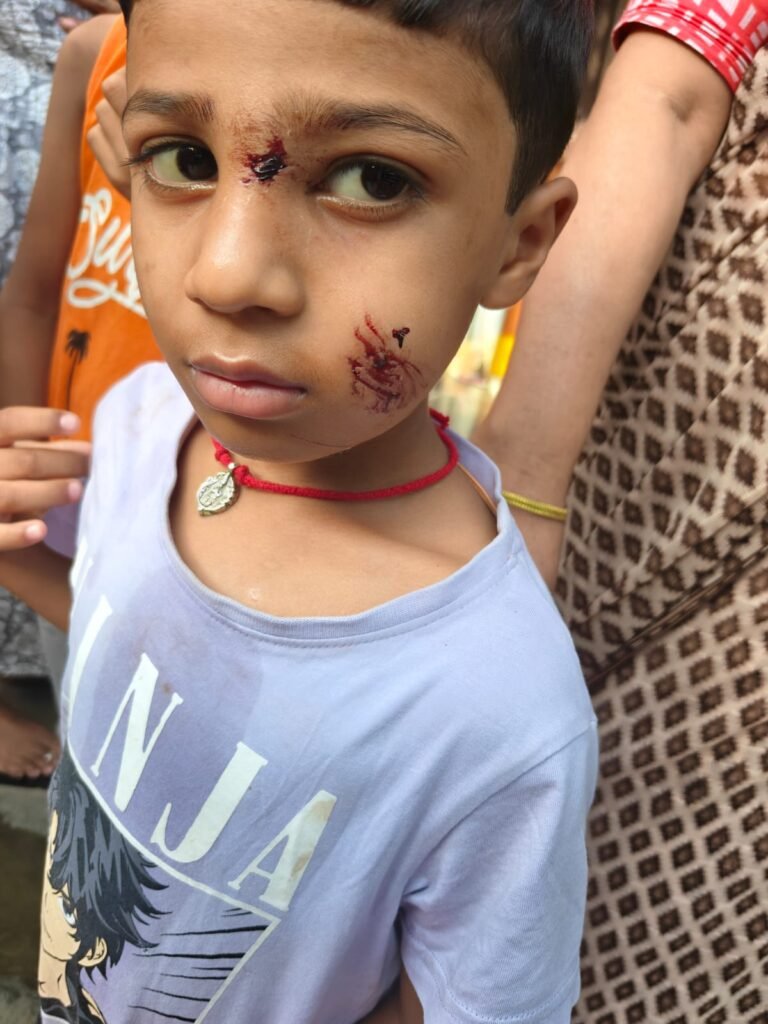మేడ్చల్‌లో వీధి కుక్కల బెడద..*